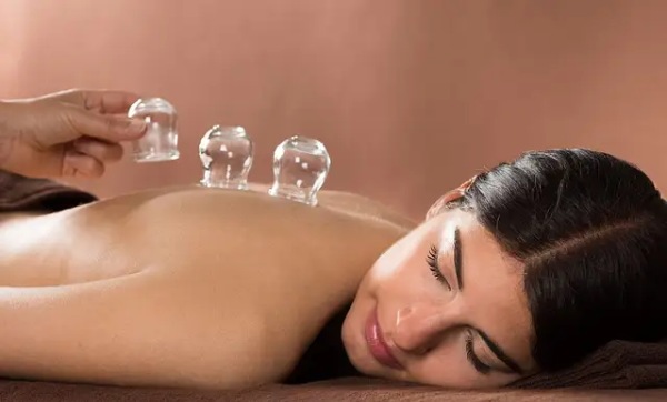 Cupping bodywork treatment on a client’s back